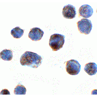 C18orf42 Antibody - Immunocytochemistry of C18orf42 in HeLa cells with C18orf42 antibody at 2 µg/mL.