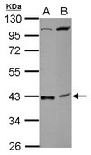 C18orf54 Antibody - Sample (30 ug of whole cell lysate) A: NT2D1 B: SK-N-SH 10% SDS PAGE C18orf54 antibody diluted at 1:1000