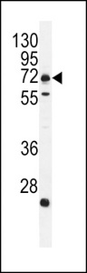 C18orf8 / MIC1; Antibody - MIC1 Antibody western blot of MDA-MB231 cell line lysates (35 ug/lane). The MIC1 antibody detected the MIC1 protein (arrow).