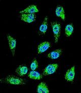 C18orf8 / MIC1; Antibody - Confocal immunofluorescence of MIC1 Antibody with MDA-MBA231 cell followed by Alexa Fluor 488-conjugated goat anti-rabbit lgG (green). DAPI was used to stain the cell nuclear (blue).