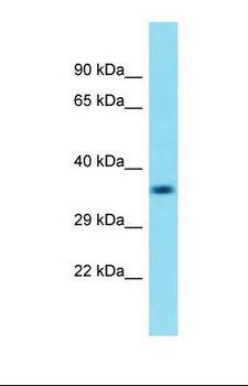 C18orf8 / MIC1; Antibody - Western blot of Human Fetal Brain. C18orf8 antibody dilution 1.0 ug/ml.  This image was taken for the unconjugated form of this product. Other forms have not been tested.