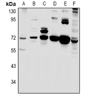 C18orf8 / MIC1; Antibody - Western blot analysis of MIC1 expression in Panc1 (A), mouse spleen (B), rat spleen (C), mouse brain (D), rat brain (E), HCT116 (F) whole cell lysates.