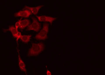 C18orf8 / MIC1; Antibody - Staining HeLa cells by IF/ICC. The samples were fixed with PFA and permeabilized in 0.1% Triton X-100, then blocked in 10% serum for 45 min at 25°C. The primary antibody was diluted at 1:200 and incubated with the sample for 1 hour at 37°C. An Alexa Fluor 594 conjugated goat anti-rabbit IgG (H+L) Ab, diluted at 1/600, was used as the secondary antibody.