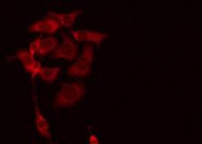 C18orf8 / MIC1; Antibody - Staining HeLa cells by IF/ICC. The samples were fixed with PFA and permeabilized in 0.1% Triton X-100, then blocked in 10% serum for 45 min at 25°C. The primary antibody was diluted at 1:200 and incubated with the sample for 1 hour at 37°C. An Alexa Fluor 594 conjugated goat anti-rabbit IgG (H+L) Ab, diluted at 1/600, was used as the secondary antibody.