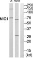 C18orf8 / MIC1; Antibody - Western blot analysis of extracts from Jurkat cells and HepG2 cells, using MIC1 antibody.