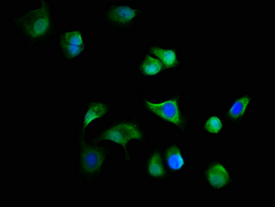 C19orf12 Antibody - Immunofluorescence staining of MCF-7 cells with C19orf12 Antibody at 1:166, counter-stained with DAPI. The cells were fixed in 4% formaldehyde, permeabilized using 0.2% Triton X-100 and blocked in 10% normal Goat Serum. The cells were then incubated with the antibody overnight at 4°C. The secondary antibody was Alexa Fluor 488-congugated AffiniPure Goat Anti-Rabbit IgG(H+L).