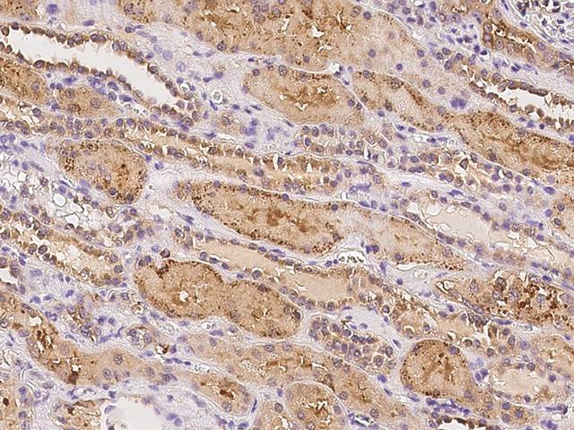 C19orf18 Antibody - Immunochemical staining of human C19orf18 in human kidney with rabbit polyclonal antibody at 1:100 dilution, formalin-fixed paraffin embedded sections.