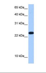 C19orf24 Antibody - Placenta cell lysate. Antibody concentration: 0.5 ug/ml. Gel concentration: 15%.  This image was taken for the unconjugated form of this product. Other forms have not been tested.