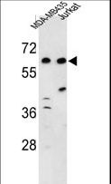 C19orf26 Antibody - Western blot of C19orf26 Antibody in MDA-MB435, Jurkat cell line lysates (35 ug/lane). C19orf26 (arrow) was detected using the purified antibody.