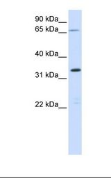 C19orf47 Antibody - Fetal muscle lysate. Antibody concentration: 1.0 ug/ml. Gel concentration: 12%.  This image was taken for the unconjugated form of this product. Other forms have not been tested.