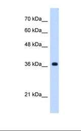 C19orf47 Antibody - Jurkat cell lysate. Antibody concentration: 0.25 ug/ml. Gel concentration: 12%.  This image was taken for the unconjugated form of this product. Other forms have not been tested.