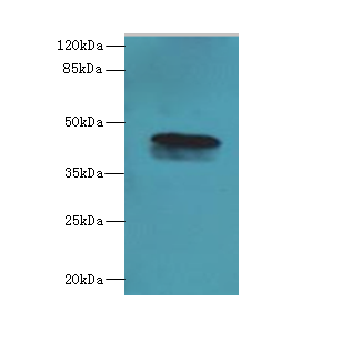 C19orf47 Antibody - Western blot. All lanes: C19orf47 antibody at 10 ug/ml+ Mouse muscle tissue Goat polyclonal to rabbit at 1:10000 dilution. Predicted band size: 45 kDa. Observed band size: 45 kDa.