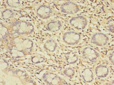 C19orf47 Antibody - Immunohistochemistry of paraffin-embedded human small intestine tissue using antibody at dilution of 1:100.
