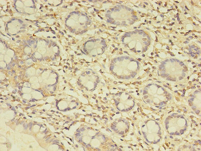 C19orf47 Antibody - Immunohistochemistry of paraffin-embedded human small intestine tissue using C19orf47 Antibody at dilution of 1:100