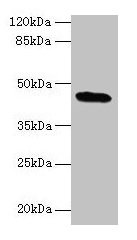 C19orf47 Antibody - Western blot All lanes: C19orf47 antibody at 10µg/ml + Mouse muscle tissue Secondary Goat polyclonal to rabbit IgG at 1/10000 dilution Predicted band size: 45, 38, 30 kDa Observed band size: 45 kDa