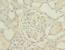 C19orf48 Antibody - Immunohistochemistry of paraffin-embedded human kidney tissue at dilution 1:100