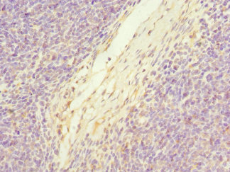 C19orf48 Antibody - Immunohistochemistry of paraffin-embedded human thymus tissue at dilution 1:100