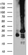 C19orf52 Antibody - HEK293T cells were transfected with the pCMV6-ENTRY control. (Left lane) or pCMV6-ENTRY C19orf52. (Right lane) cDNA for 48 hrs and lysed