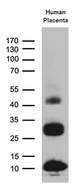 C19orf52 Antibody - Western blot analysis of extracts. (35ug) from human placenta lysate by using anti-C19orf52 monoclonal antibody. (1:500)