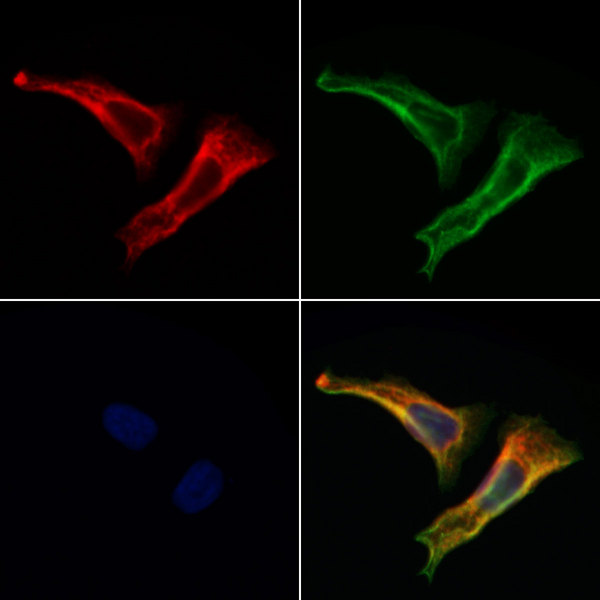 C19orf52 Antibody - Staining HeLa cells by IF/ICC. The samples were fixed with PFA and permeabilized in 0.1% Triton X-100, then blocked in 10% serum for 45 min at 25°C. Samples were then incubated with primary Ab(1:200) and mouse anti-beta tubulin Ab(1:200) for 1 hour at 37°C. An AlexaFluor594 conjugated goat anti-rabbit IgG(H+L) Ab(1:200 Red) and an AlexaFluor488 conjugated goat anti-mouse IgG(H+L) Ab(1:600 Green) were used as the secondary antibod