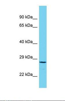 C19orf57 Antibody - Western blot of Human RPMI-8226. C19orf57 antibody dilution 1.0 ug/ml.  This image was taken for the unconjugated form of this product. Other forms have not been tested.