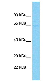 C19orf68 Antibody - C19orf68 antibody Western Blot of COLO205. Antibody dilution: 1 ug/ml.  This image was taken for the unconjugated form of this product. Other forms have not been tested.