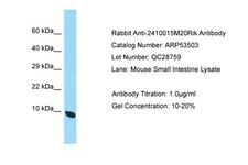 C19orf70 / QIL1 Antibody -  This image was taken for the unconjugated form of this product. Other forms have not been tested.