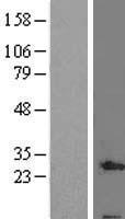 C19orf70 / QIL1 Protein - Western validation with an anti-DDK antibody * L: Control HEK293 lysate R: Over-expression lysate