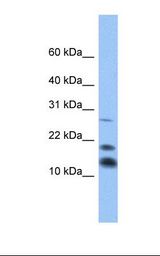 C1D Antibody - Fetal heart lysate. Antibody concentration: 1.0 ug/ml. Gel concentration: 10-20%.  This image was taken for the unconjugated form of this product. Other forms have not been tested.