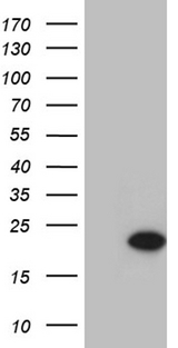 C1D Antibody - HEK293T cells were transfected with the pCMV6-ENTRY control. (Left lane) or pCMV6-ENTRY C1D. (Right lane) cDNA for 48 hrs and lysed. Equivalent amounts of cell lysates. (5 ug per lane) were separated by SDS-PAGE and immunoblotted with anti-C1D. (1:2000)