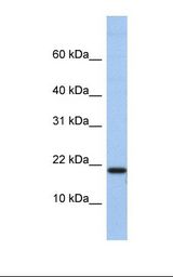 C1D Antibody - Hela cell lysate. Antibody concentration: 1.0 ug/ml. Gel concentration: 10-20%.  This image was taken for the unconjugated form of this product. Other forms have not been tested.