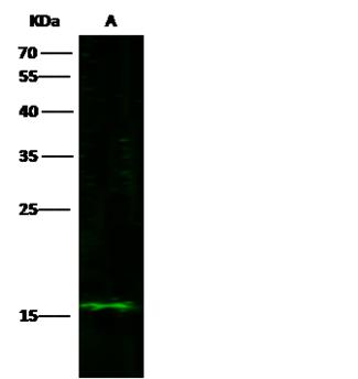 C1D Antibody - Anti-C1D rabbit polyclonal antibody at 1:500 dilution. Lane A: Hela Whole Cell Lysate. Lysates/proteins at 30 ug per lane. Secondary: Goat Anti-Rabbit IgG H&L (Dylight800) at 1/10000 dilution. Developed using the Odyssey technique. Performed under reducing conditions. Predicted band size: 16 kDa. Observed band size: 15 kDa.