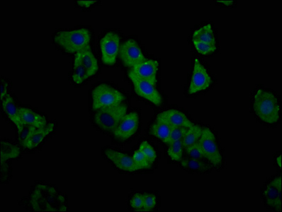 C1GALT1 Antibody - Immunofluorescence staining of HepG2 cells at a dilution of 1:333, counter-stained with DAPI. The cells were fixed in 4% formaldehyde, permeabilized using 0.2% Triton X-100 and blocked in 10% normal Goat Serum. The cells were then incubated with the antibody overnight at 4°C.The secondary antibody was Alexa Fluor 488-congugated AffiniPure Goat Anti-Rabbit IgG (H+L) .