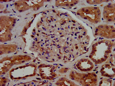 C1GALT1 Antibody - Immunohistochemistry image at a dilution of 1:1000 and staining in paraffin-embedded human kidney tissue performed on a Leica BondTM system. After dewaxing and hydration, antigen retrieval was mediated by high pressure in a citrate buffer (pH 6.0) . Section was blocked with 10% normal goat serum 30min at RT. Then primary antibody (1% BSA) was incubated at 4 °C overnight. The primary is detected by a biotinylated secondary antibody and visualized using an HRP conjugated SP system.