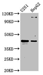 C1GALT1 Antibody - Positive Western Blot detected in U251 whole cell lysate, HepG2 whole cell lysate. All lanes: C1GALT1 antibody at 4.4 µg/ml Secondary Goat polyclonal to rabbit IgG at 1/50000 dilution. Predicted band size: 43, 36 KDa. Observed band size: 43 KDa