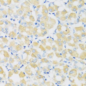 C1GALT1 Antibody - Immunohistochemistry of paraffin-embedded Human stomach using C1GALT1 Polyclonal Antibody at dilution of 1:100 (40x lens).