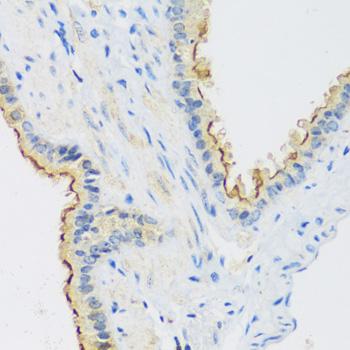 C1GALT1 Antibody - Immunohistochemistry of paraffin-embedded Mouse lung using C1GALT1 Polyclonal Antibody at dilution of 1:100 (40x lens).