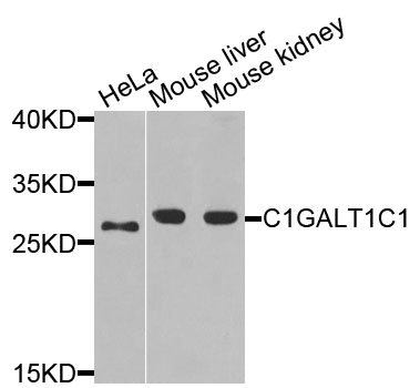 C1GALT1C1 Antibody - Western blot blot of extracts of various cells, using C1GALT1C1 antibody.