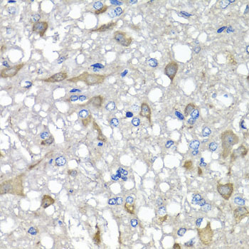 C1GALT1C1 Antibody - Immunohistochemistry of paraffin-embedded rat brain using C1GALT1C1 antibody at dilution of 1:100 (x40 lens).