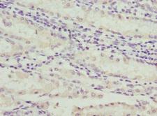 C1GALT1C1 Antibody - Immunohistochemistry of paraffin-embedded human gastric cancer at dilution 1:100