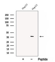 C1GALT1C1 Antibody - Western blot analysis of extracts of HepG2 cells using COSMC antibody. The lane on the left was treated with blocking peptide.