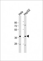 C1GALT1C1 Antibody - All lanes: Anti-C1GALT1C1 Antibody (N-Term) at 1:2000 dilution Lane 1: Hela whole cell lysate Lane 2: HepG2 whole cell lysate Lysates/proteins at 20 µg per lane. Secondary Goat Anti-Rabbit IgG, (H+L), Peroxidase conjugated at 1/10000 dilution. Predicted band size: 36 kDa Blocking/Dilution buffer: 5% NFDM/TBST.