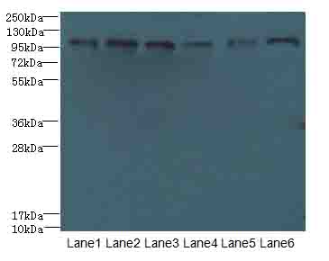 C1orf101 Antibody - Western blot. All lanes: C1orf101 antibody at 6 ug/ml. Lane 1: U87 whole cell lysate. Lane 2: HepG-2 whole cell lysate. Lane 3: A549 whole cell lysate. Lane 4: Mouse lung tissue. Lane 5: Mouse liver tissue. Lane 6: PC-3 whole cell lysate. Secondary Goat polyclonal to Rabbit IgG at 1:10000 dilution. Predicted band size: 110 kDa. Observed band size: 110 kDa.
