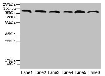 C1orf101 Antibody - Western blot All lanes: C1orf101 antibody at 6µg/ml Lane 1: U87 whole cell lysate Lane 2: HepG2 whole cell lysate Lane 3: A549 whole cell lysate Lane 4: Mouse lung tissue Lane 5: Mouse liver tissue Lane 6: PC-3 whole cell lysate Secondary Goat polyclonal to rabbit IgG at 1/10000 dilution Predicted band size: 110, 96, 93 kDa Observed band size: 110 kDa