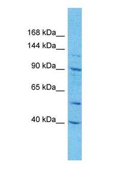 C1orf101 Antibody - Western blot of CA101 Antibody with human A549 Whole Cell lysate.  This image was taken for the unconjugated form of this product. Other forms have not been tested.