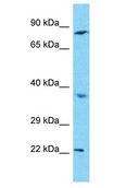 C1orf105 Antibody - C1orf105 antibody Western Blot of HepG2. Antibody dilution: 1 ug/ml.  This image was taken for the unconjugated form of this product. Other forms have not been tested.