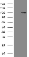 C1orf106 Antibody - HEK293T cells were transfected with the pCMV6-ENTRY control. (Left lane) or pCMV6-ENTRY C1orf106. (Right lane) cDNA for 48 hrs and lysed. Equivalent amounts of cell lysates. (5 ug per lane) were separated by SDS-PAGE and immunoblotted with anti-C1orf106. (1:2000)