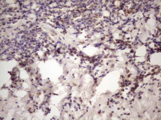 C1orf106 Antibody - IHC of paraffin-embedded Human tonsil using anti-C1orf106 mouse monoclonal antibody. (Heat-induced epitope retrieval by 1 mM EDTA in 10mM Tris, pH8.5, 120°C for 3min)(1:150).