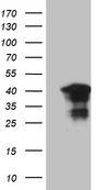C1orf111 Antibody - HEK293T cells were transfected with the pCMV6-ENTRY control. (Left lane) or pCMV6-ENTRY C1orf111. (Right lane) cDNA for 48 hrs and lysed