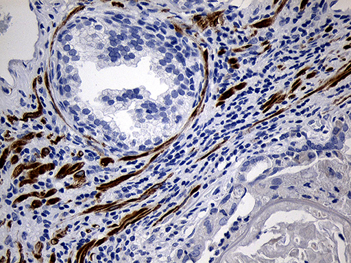 C1orf111 Antibody - Immunohistochemical staining of paraffin-embedded Human prostate tissue within the normal limits using anti-C1orf111 mouse monoclonal antibody. (Heat-induced epitope retrieval by 1mM EDTA in 10mM Tris buffer. (pH8.5) at 120°C for 3 min. (1:1000)